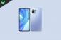 Xiaomi Mi 11 Lite-arkiver